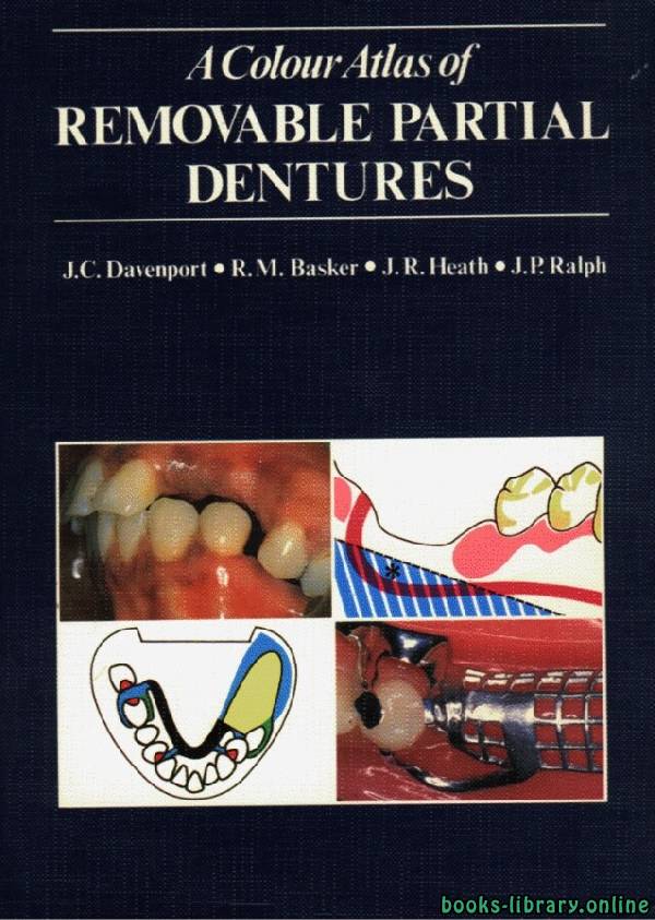 ❞ كتاب color atlas of removable partial dentures ❝  ⏤ كاتب غير معروف