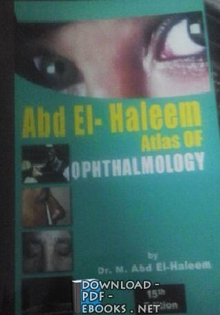❞ كتاب Summary Of OPHTHALMOLOGY P2 Book ❝  ⏤ عبد الحليم (دكتور)