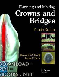 ❞ كتاب Planning and Making Crowns and Bridges ❝ 