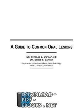 A GUIDE TO COMMON ORAL LESIONS