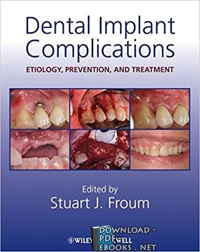 Dental Implant Complications